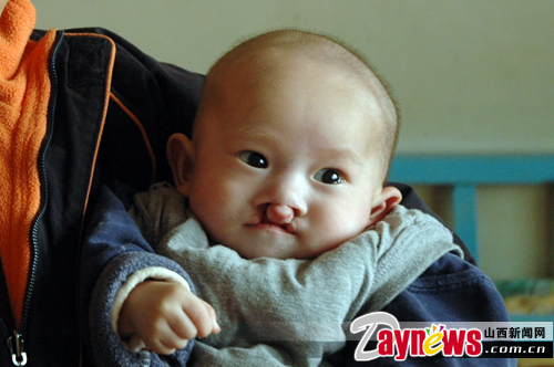 芜湖有训练腭裂孩子说话效果好的地方吗