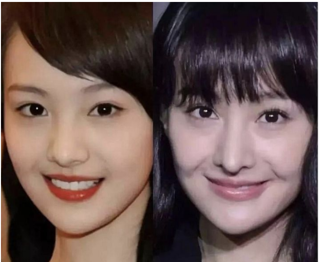 她一步步走向粗致越来越美越来越有气质,娱乐圈整容turn车的真的很多